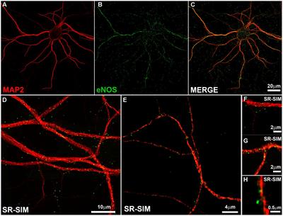 Frontiers | Endothelial Nitric Oxide Synthase Is Present In Dendritic ...